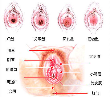 科普圖解：處女膜在陰道什麼位置