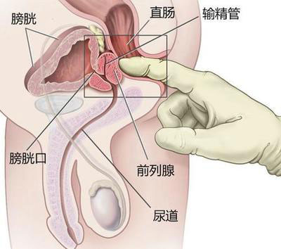 詳解女性陰蒂陰道口的位置(高清圖)